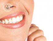 Il rivestimento dei denti con faccette e corone
