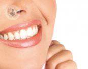 il-rivestimento-dei-denti-con-faccette-e-corone immagine dell'articolo