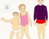 Problemi di sviluppo di postura delle gambe nei bambini
