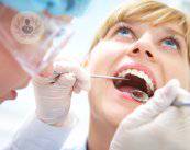 La Parodontite: l'epidemia invisibile del cavo orale