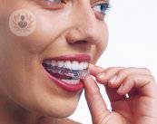 protesi-dentarie-la-soluzione-efficace-per-il-tuo-sorriso immagine dell'articolo