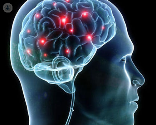 come-si-realizza-il-processo-di-riabilitazione-per-lesioni-cerebrali immagine dell'articolo