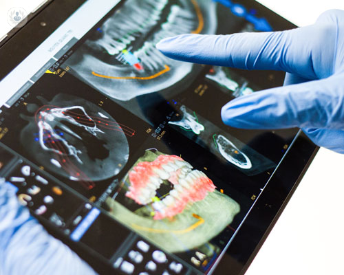 la-chirurgia-guidata-come-sostegno-per-l-odontoiatria immagine dell'articolo