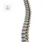 Un nuovo sistema per stabilizzare la colonna vertebrale