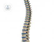 un-nuovo-sistema-per-stabilizzare-la-colonna-vertebrale immagine dell'articolo