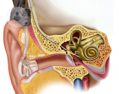 L'ipoacusia: la patologia dell'orecchio
