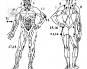 mangiare-bene-per-prevenire-la-fibromialgia immagine dell'articolo
