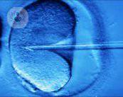 Come avviene la fecondazione in vitro con iniezione di sperma