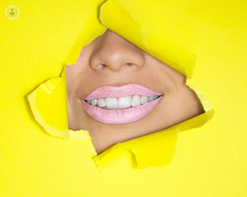 poco-spazio-in-bocca-l-affollamento-dentale-e-le-sue-soluzioni immagine dell'articolo