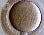 la-crioconservazione-la-salvaguardia-della-fertilita immagine dell'articolo