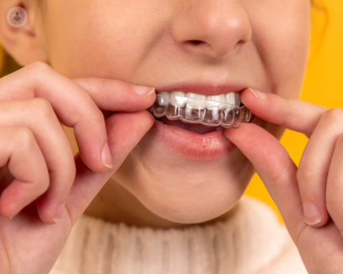 tipologie-di-trattamenti-dentali-dalla-a-alla-z immagine dell'articolo