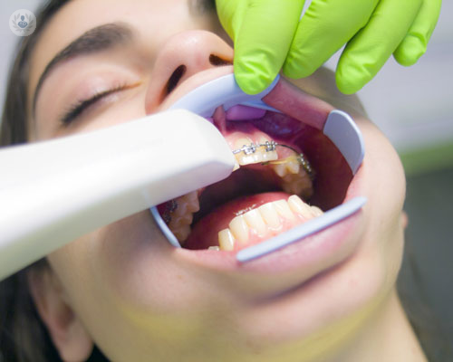 l-odontoiatria-infantile-e-le-sue-caratteristiche immagine dell'articolo
