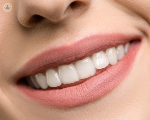 Sbiancamento dentale: la scelta giusta per il sorriso perfetto