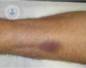 i-fattori-di-crescita-i-trattamenti-adeguati-per-curare-le-lesioni immagine dell'articolo