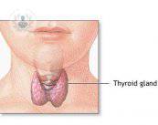 Le malattie della tiroide: diagnosi e trattamento