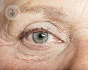 per-cosa-si-usano-le-lenti-intraoculari immagine dell'articolo