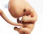 spina-bifida-di-che-patologia-si-tratta immagine dell'articolo