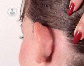 Otoplastica: come correggere la posizione delle orecchie