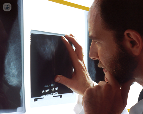 brachiterapia-la-migliore-cura-per-il-cancro-alla-prostata immagine dell'articolo