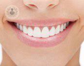 killer-questions-tutto-quello-che-dovresti-sapere-sugli-impianti-dentali immagine dell'articolo