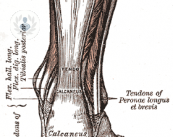 tipologie-di-lesioni-al-tendine-di-achille immagine dell'articolo