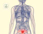 novita-nella-diagnosi-dei-tumori-ginecologici immagine dell'articolo