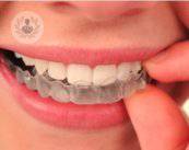 Invasilign: l'ortodonzia estetica all'avanguardia