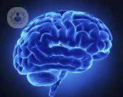 ictus-sintomi-trattamento-e-fattori-di-rischio immagine dell'articolo