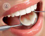 nuove-tecniche-di-implantologia-dentale immagine dell'articolo