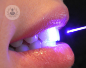 Il laser più utile per la chirurgia odontoiatrica