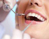 le-domande-piu-comuni-dell-endodonzia immagine dell'articolo