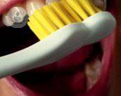 prevenire-e-trattare-la-paradontite immagine dell'articolo