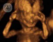 ecografie-4d-un-progresso-per-la-diagnostica immagine dell'articolo