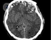 la-riabilitazione-cognitiva-in-pazienti-con-danni-cerebrali immagine dell'articolo
