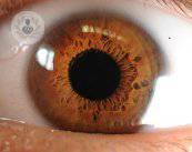 Le curiosità più comuni sulle lenti intraoculari