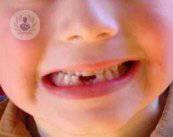 l-odontoiatria-pediatrica-in-pazienti-con-disabilita immagine dell'articolo