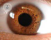 chirurgia-della-presbiopia-con-lenti-intraoculari immagine dell'articolo
