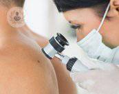 dermatoscopia-la-mappatura-con-lenti immagine dell'articolo