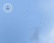 la-retinopatia-diabetica-puo-provocare-la-perdita-della-vista immagine dell'articolo