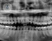 e-necessario-estrarre-i-denti-del-giudizio immagine dell'articolo