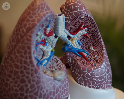 Come trattare il cancro al polmone