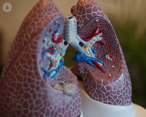 conoscere-in-modo-approfondito-il-cancro-al-polmone immagine dell'articolo