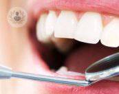 Protesi dentali: quali scegliere?