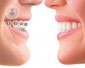 I trattamenti ortodontici personalizzati per 'età