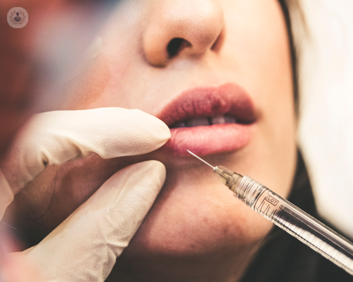 filler-all-acido-ialuronico-per-le-labbra immagine dell'articolo