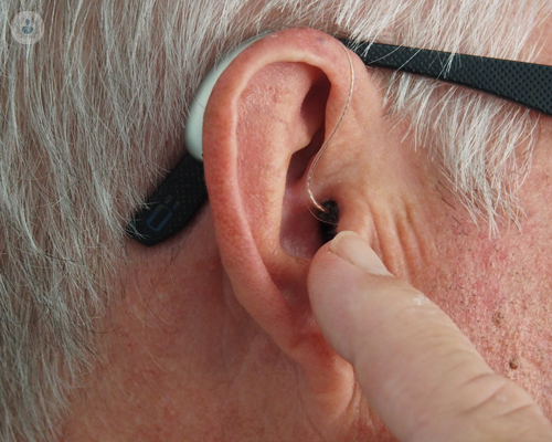 Otosclerosi: può essere la causa della tua perdita dell'udito