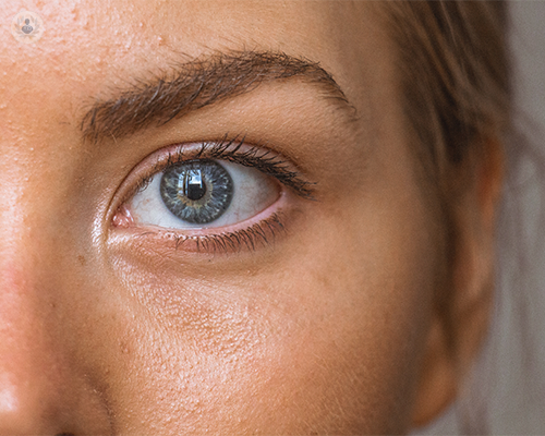 Sconfiggere le occhiaie: i segreti del trattamento con acido ialuronico