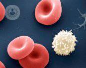 l-anemia-e-solo-un-sintomo-bisogna-cercare-la-causa immagine dell'articolo