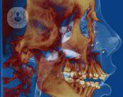 Terapie multidisciplinari: ortodonzia e gnatologia
