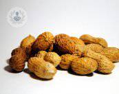 le-allergie-alimentari-si-manifestano-in-qualsiasi-momento-della-vita immagine dell'articolo